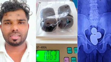 Potat four capsules, then 1 kg of gold;  Tskarala Gheun Police Airport Avroon Thet Hospital