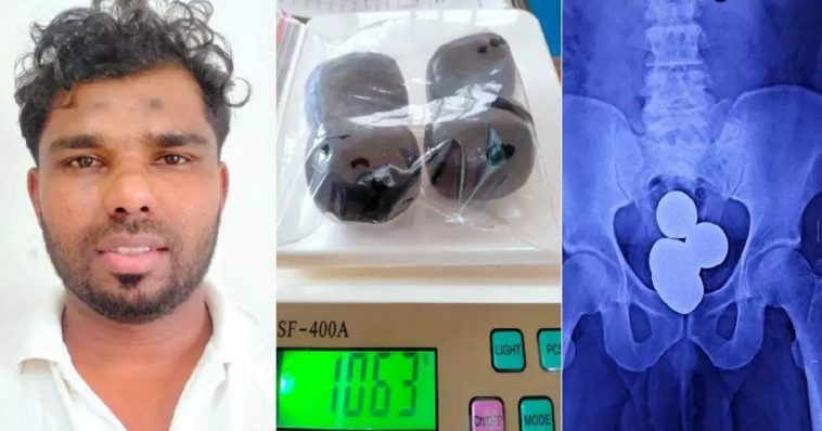 Potat four capsules, then 1 kg of gold;  Tskarala Gheun Police Airport Avroon Thet Hospital